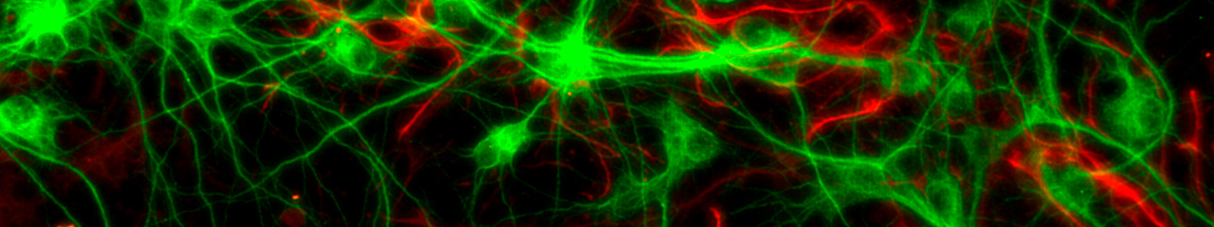 Neurons Red Nuclei